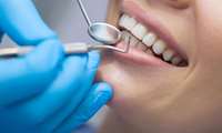 حضور دندانپزشک در مراکز خدمات جامع سلامت منتخب
